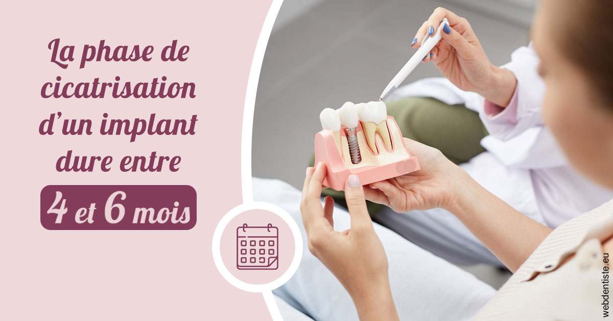 https://scp-cuenca-grocq-slonim-montoux.chirurgiens-dentistes.fr/Cicatrisation implant 2
