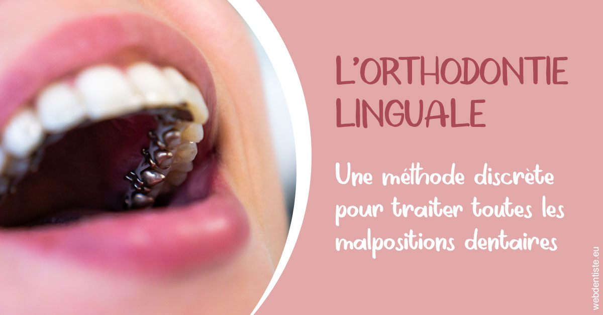 https://scp-cuenca-grocq-slonim-montoux.chirurgiens-dentistes.fr/L'orthodontie linguale 2
