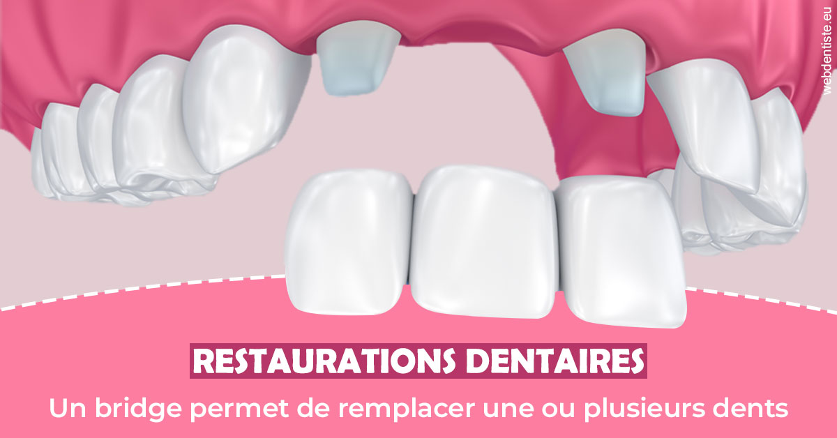 https://scp-cuenca-grocq-slonim-montoux.chirurgiens-dentistes.fr/Bridge remplacer dents 2