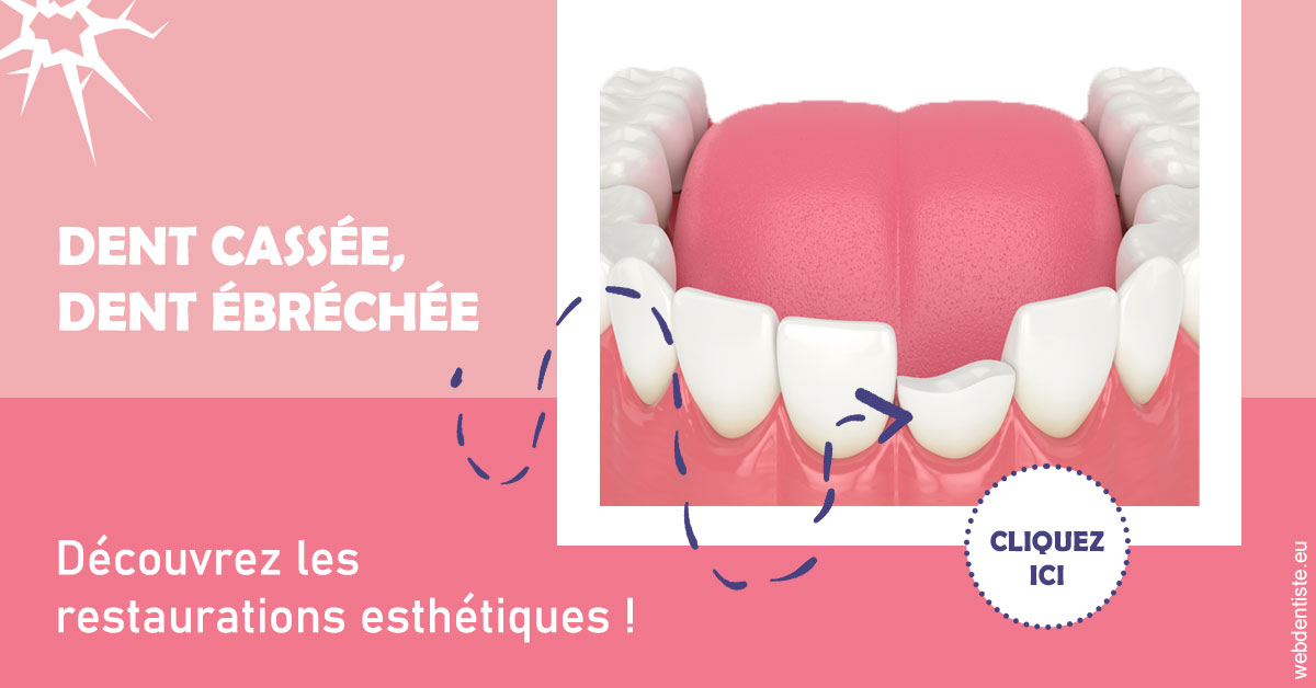 https://scp-cuenca-grocq-slonim-montoux.chirurgiens-dentistes.fr/Dent cassée ébréchée 1