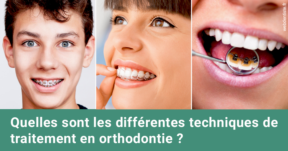 https://scp-cuenca-grocq-slonim-montoux.chirurgiens-dentistes.fr/Les différentes techniques de traitement 2