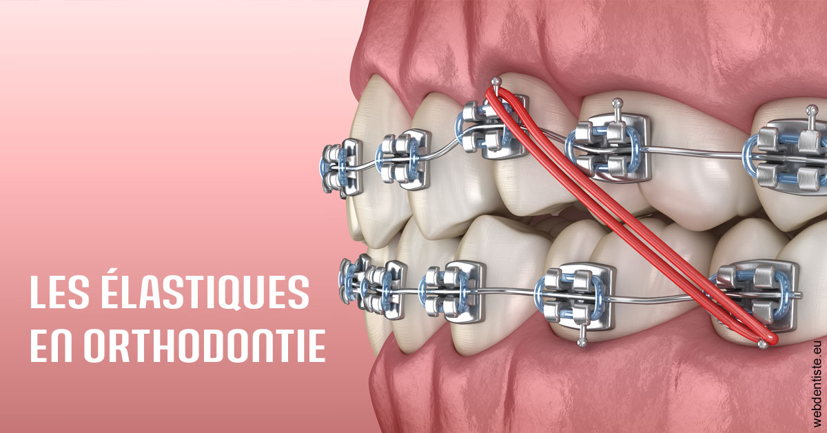 https://scp-cuenca-grocq-slonim-montoux.chirurgiens-dentistes.fr/Elastiques orthodontie 2
