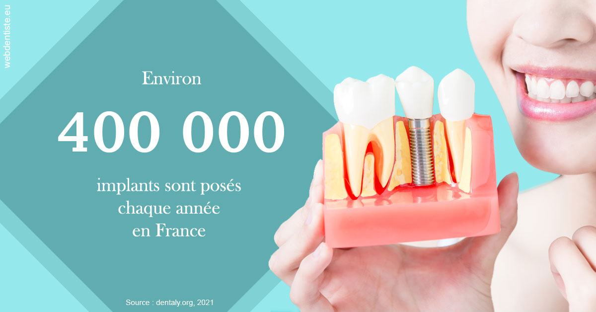 https://scp-cuenca-grocq-slonim-montoux.chirurgiens-dentistes.fr/Pose d'implants en France 2