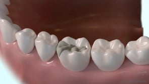 Prothèses dentaires (2)